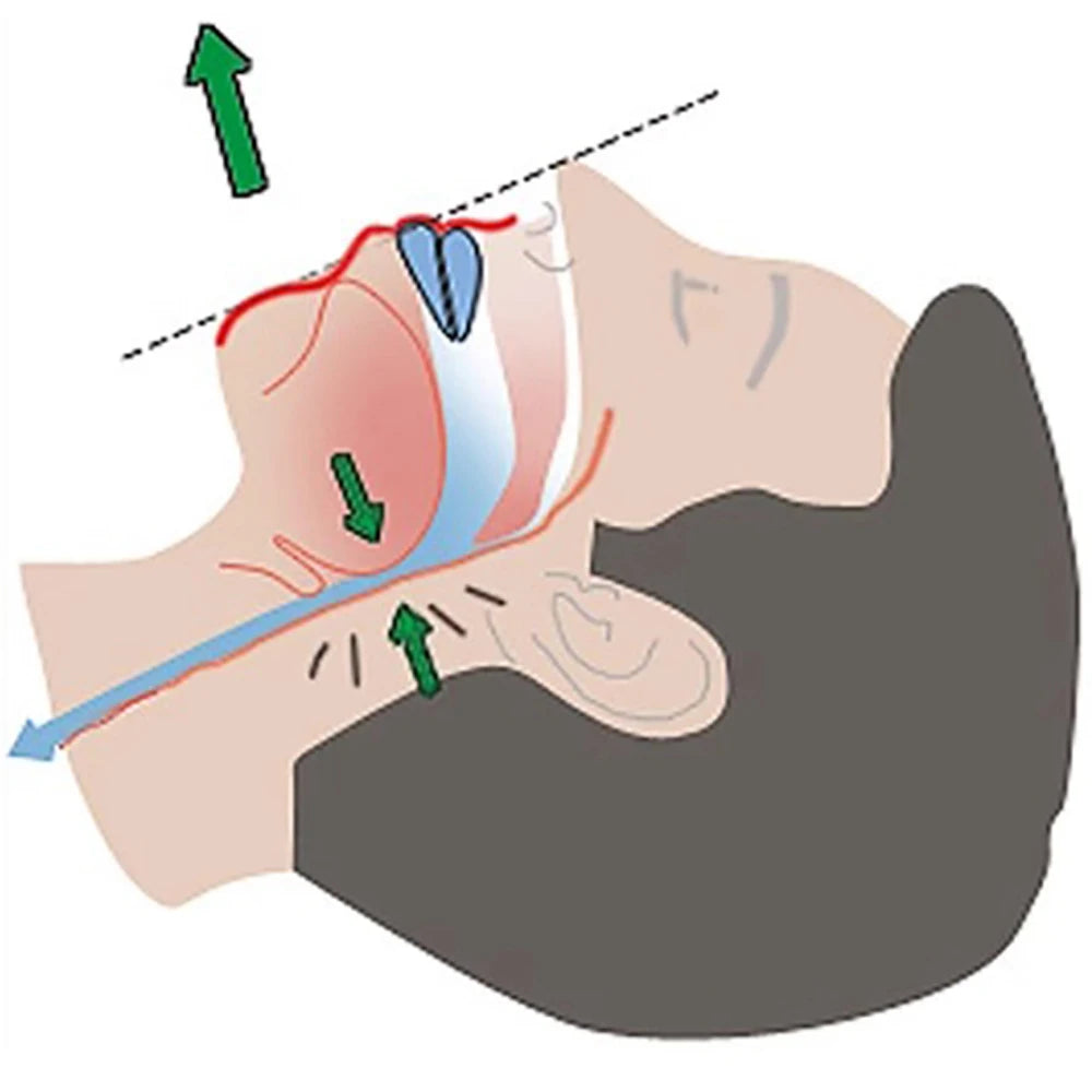 Anti-Snoring & Bruxism Mouth Guard – Sleep Better Tonight